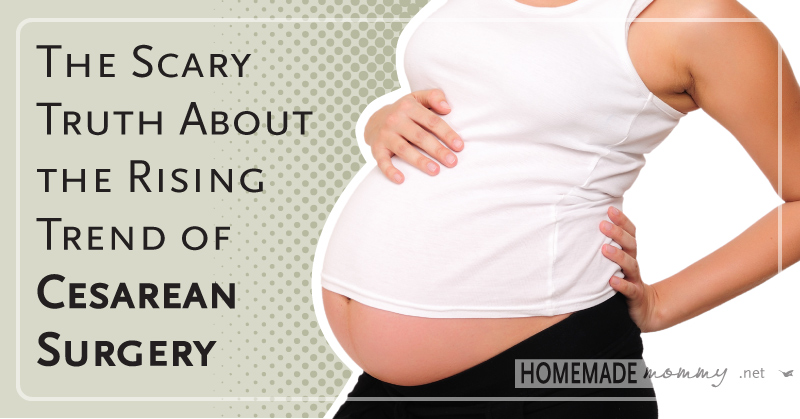 The Scary Truth About the Rising Trend of Cesarean Surgery